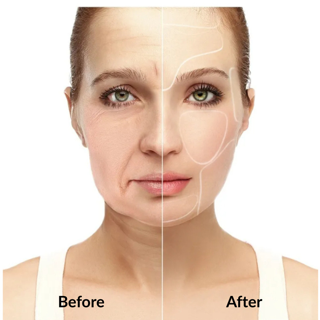 Lunaris Reusable Anti Wrinkle Patch